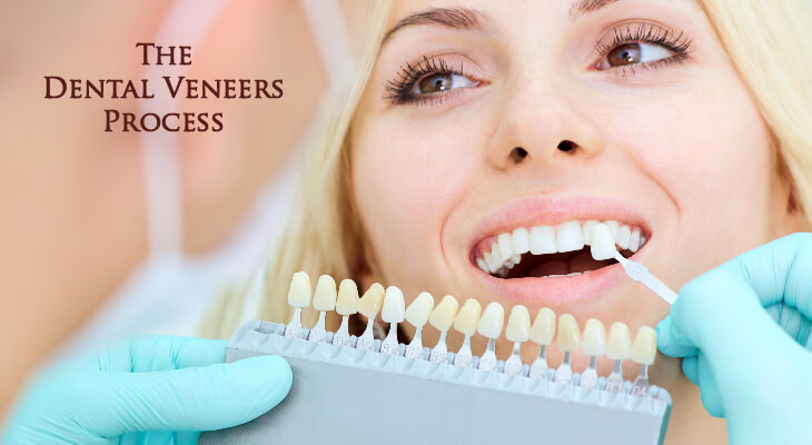 young blonde woman going through dental veneers process
