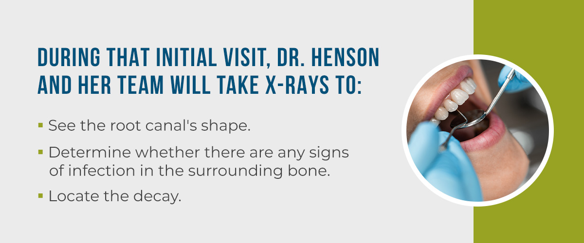initial root canal consultation steps at Henson Family Dental