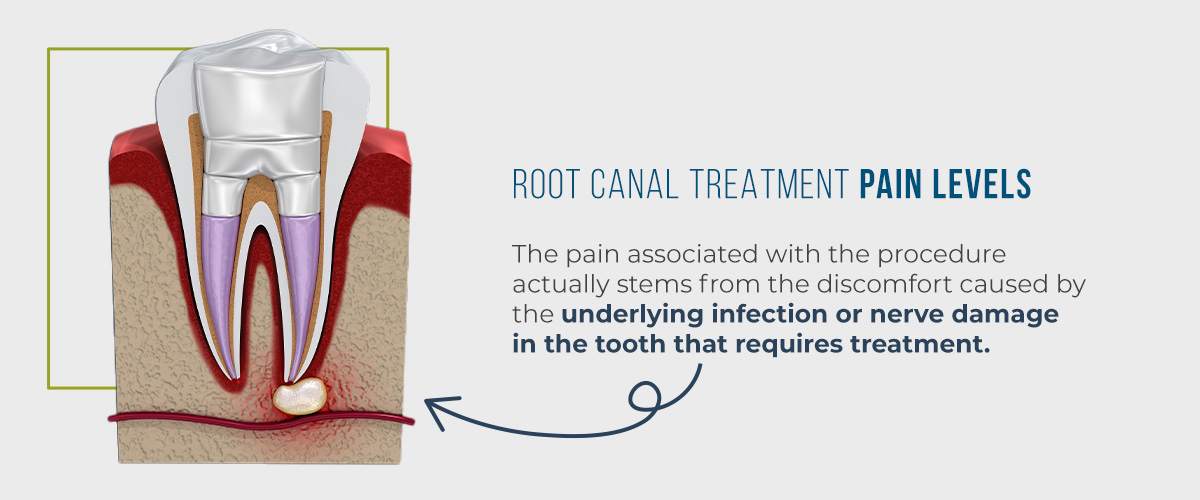 root canal treatment pain levels